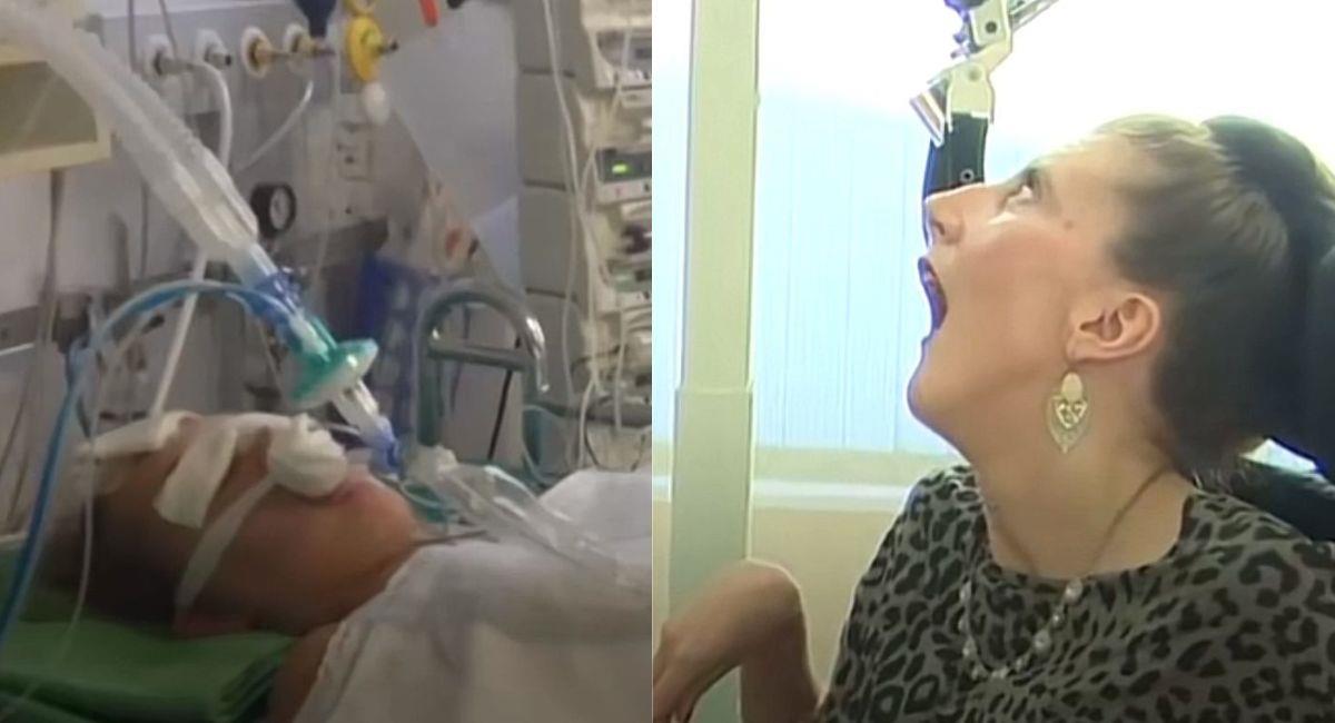 Mujer sufrió parálisis cerebral por una terrible reacción alérgica a la nueces. Foto: TikTok Captura de video @imperfectos