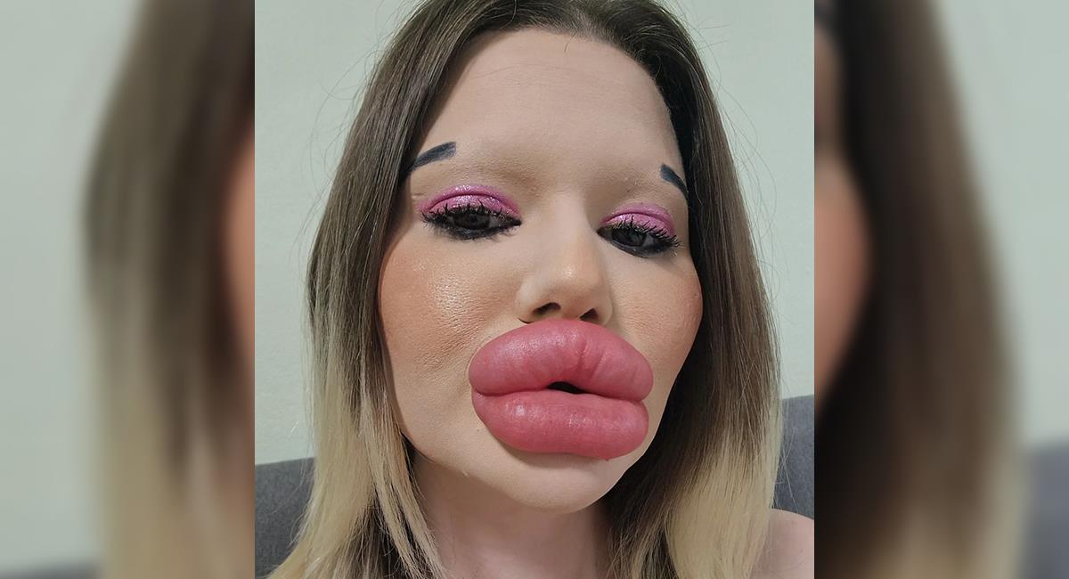 Mujer con los labios más grandes del mundo quiere romper otro récord. Foto: Instagram @andrea88476