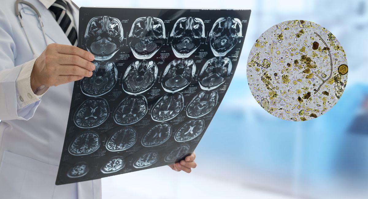 Niño de 10 años fue diagnosticado con una bacteria “devora cerebros”. Foto: Shutterstock