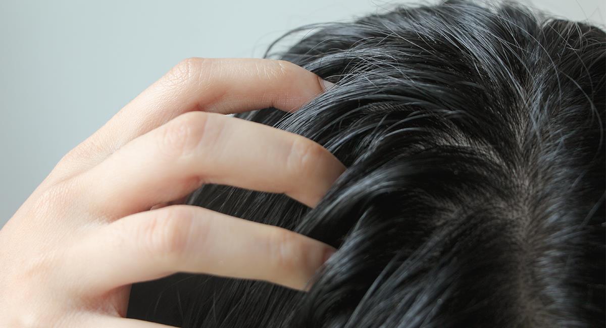 Adiós a la grasa: expertos dan 8 trucos para que el cabello dure más tiempo limpio. Foto: Shutterstock