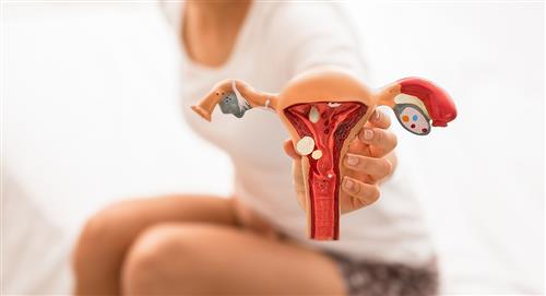 Endometriosis: la enfermedad que afecta a las mujeres