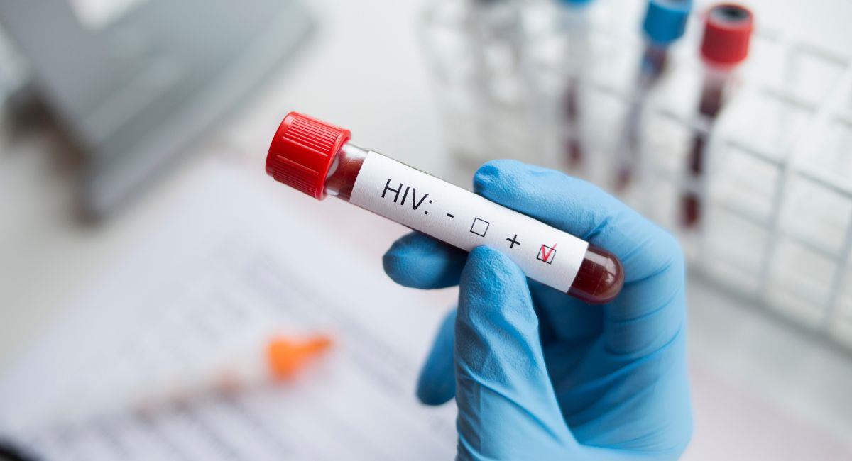 Gracias a tratamiento con células madre, mujer logró curarse del VIH. Foto: Shutterstock