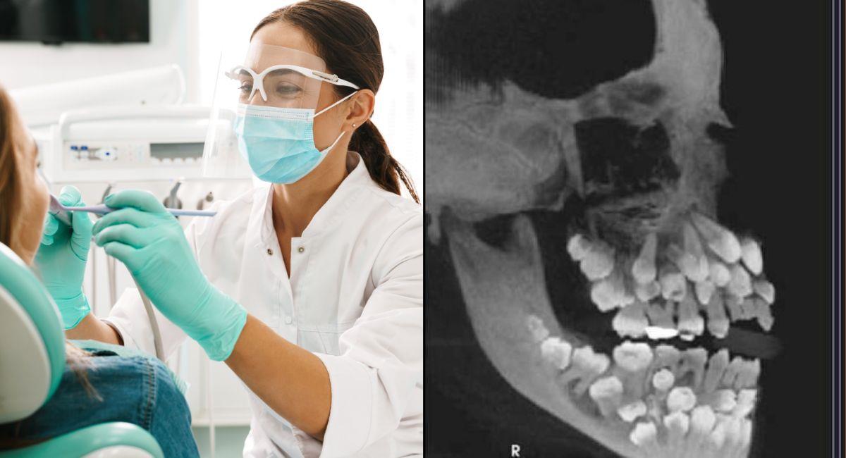 Niña acude al médico y descubre que tiene 81 dientes. Foto: Shutterstock