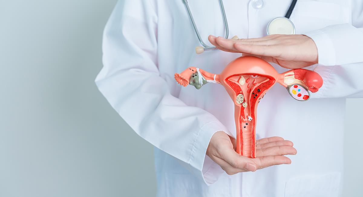 Cáncer de ovario: si tienes estos síntomas, debes consultar urgente con un médico. Foto: Shutterstock