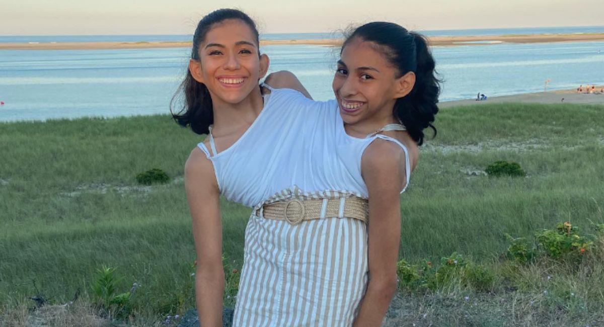 Carmen y Lupita las hermanas siamesas. Foto: Instagram @carmen_andrade2000