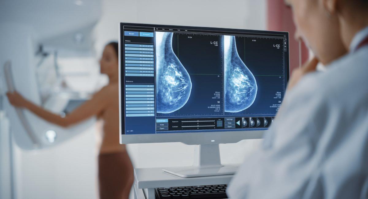 Expertos revelan la edad ideal para hacerse una mamografía. Foto: Shutterstock