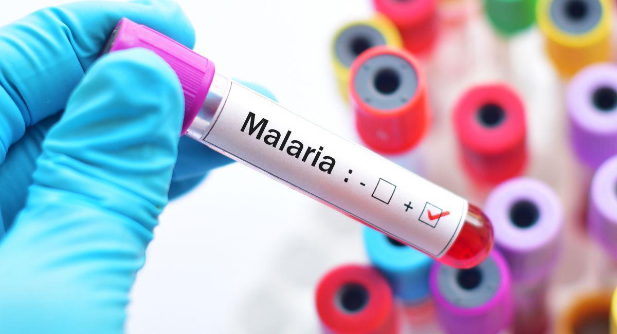 ¡Sorprendente! Crean antibiótico natural para detener la malaria. Foto: Shutterstock