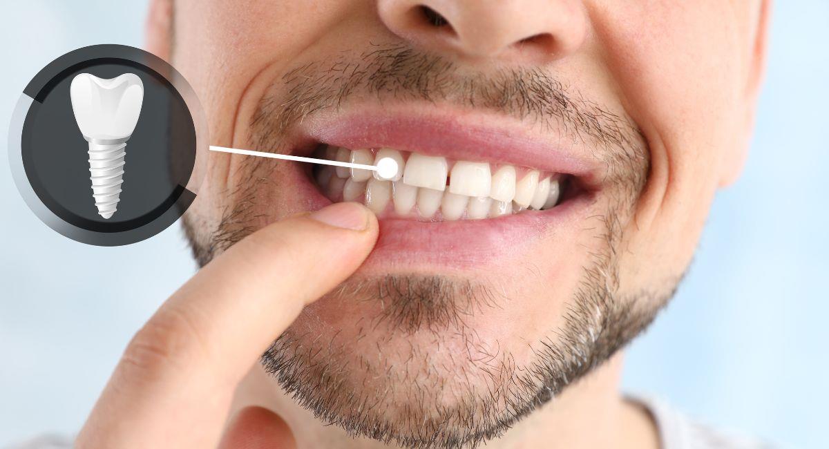 Desarrollan fármaco que haría que los dientes se regeneren. Foto: Shutterstock