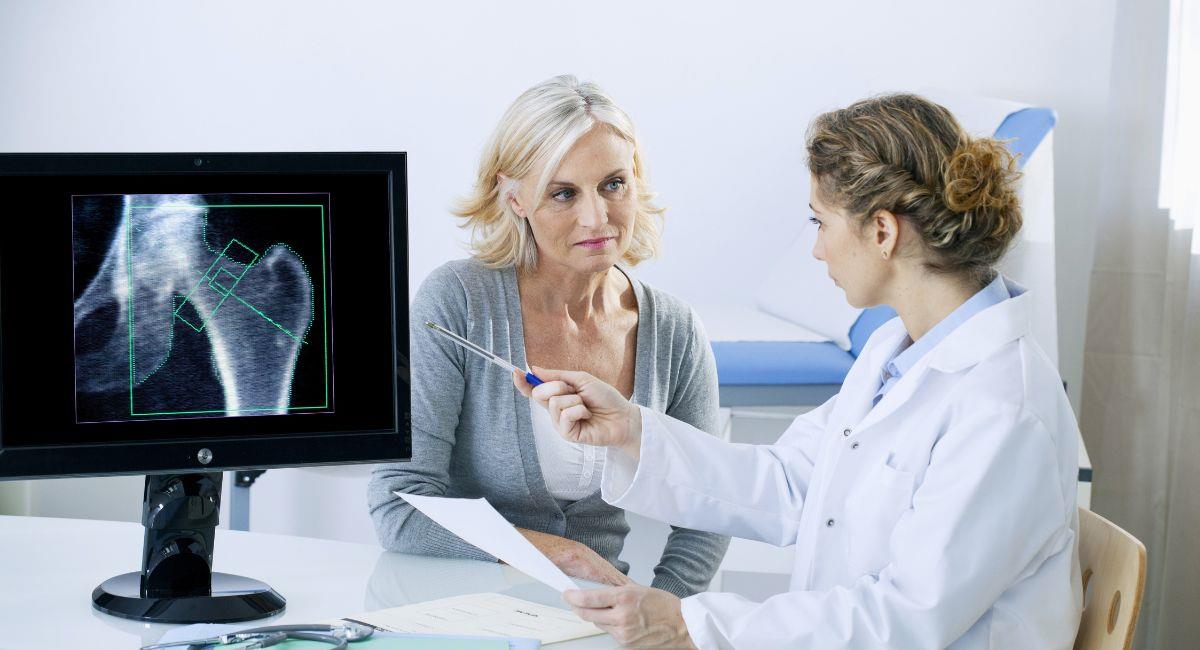 Todo lo que debes saber sobre la osteoporosis. Foto: Shutterstock
