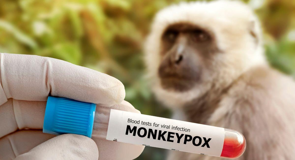 Varios países en alerta por rebrote de la viruela del mono. Foto: Shutterstock