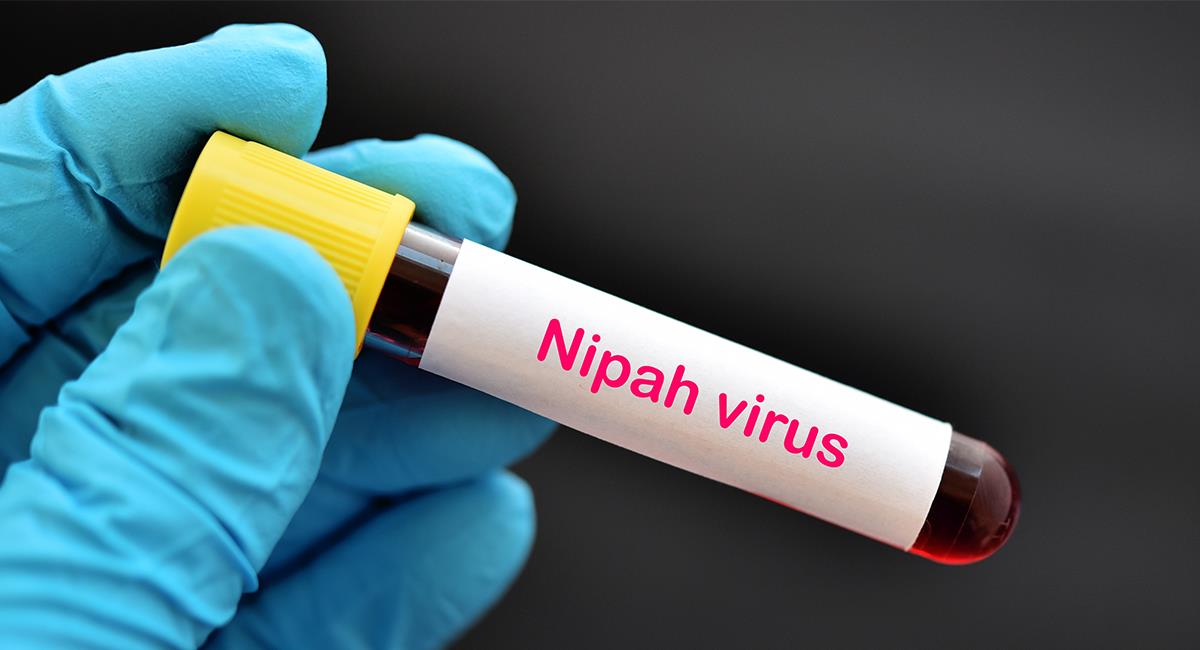 Virus Nipah: ¿qué es y cómo se transmite el mortal virus que preocupa en India?. Foto: Shutterstock