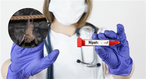 Virus Nipah: ¿qué probabilidad hay de que llegue a Colombia?
