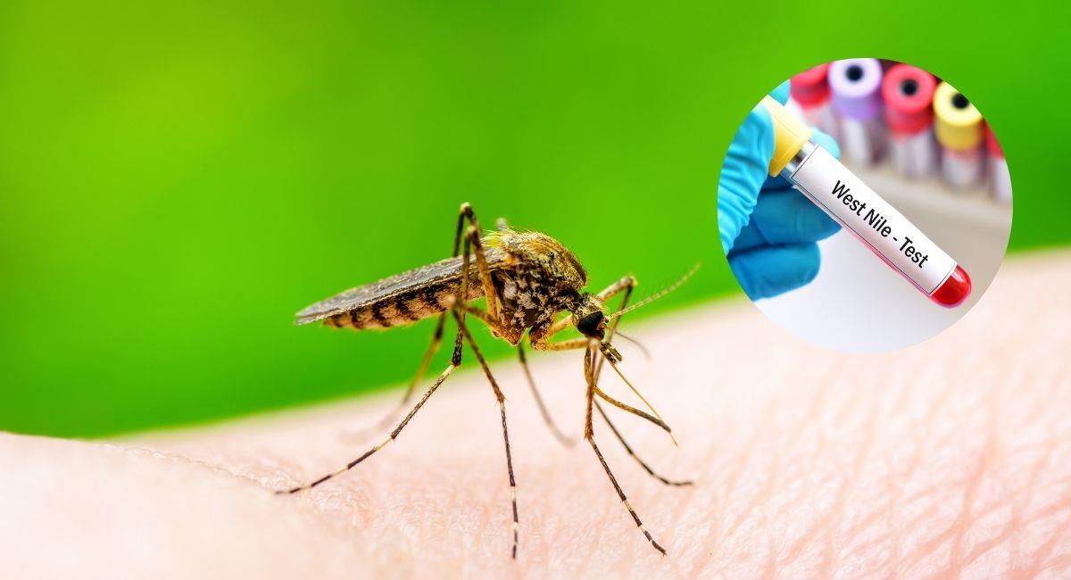 Conoce el virus que tiene en alerta a las autoridades internacionales. Foto: Shutterstock