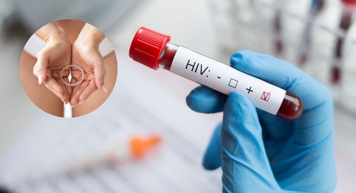 Desarrollan nuevo método para prevenir el VIH. Foto: Shutterstock