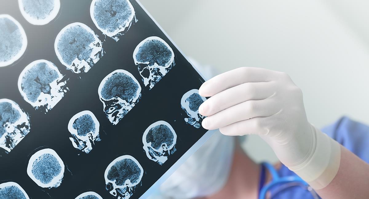 Mujer ha vivido 80 años con una aguja en su cerebro: esto dicen los médicos. Foto: Shutterstock