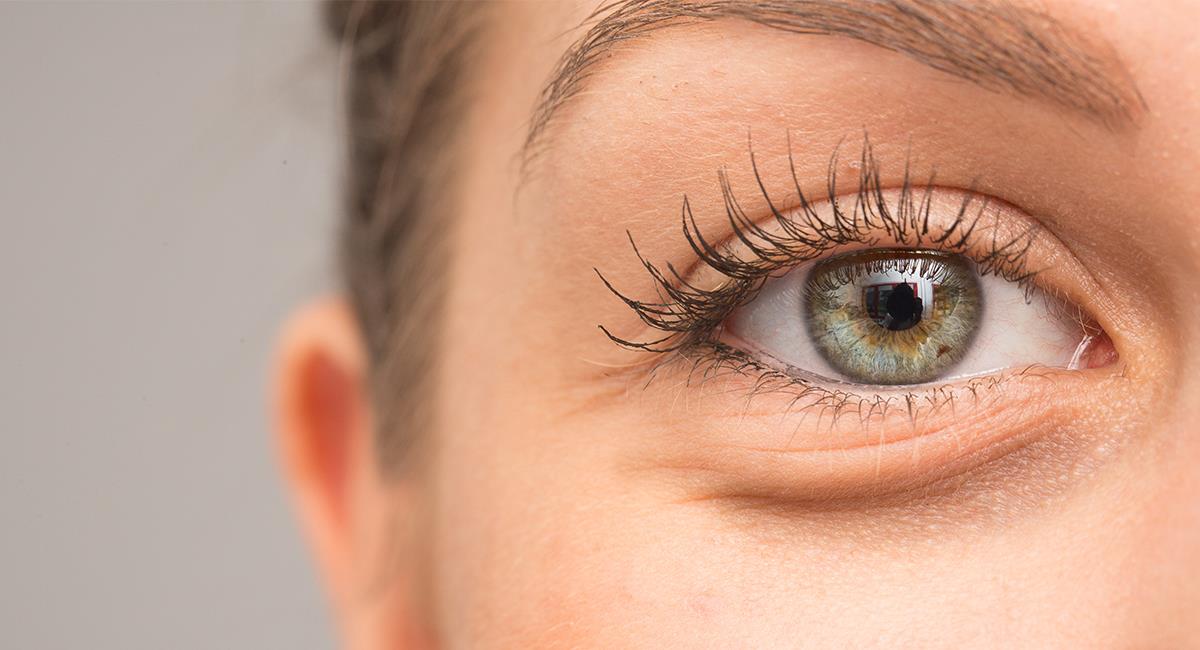 Remedios caseros para reducir las bolsas debajo de los ojos: ¿por qué aparecen?. Foto: Shutterstock
