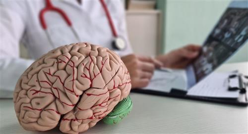 Accidente cerebrovascular: ¿qué es y cómo identificarlo?