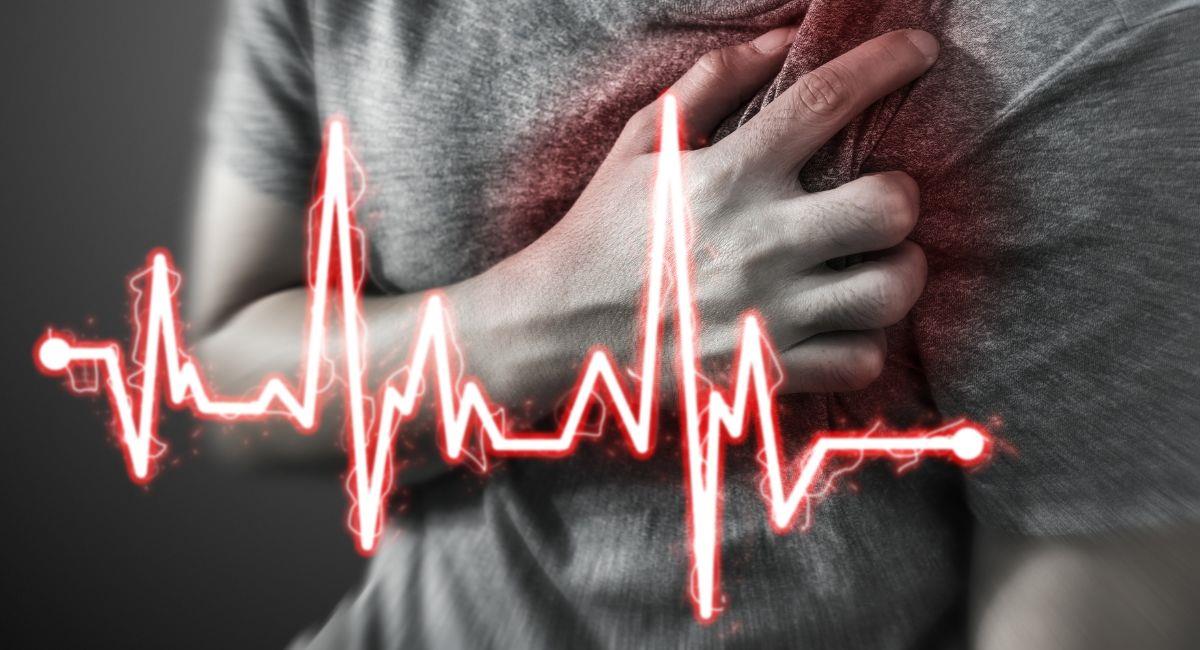 ¿Cómo diferenciar un infarto de un preinfarto?. Foto: Shutterstock
