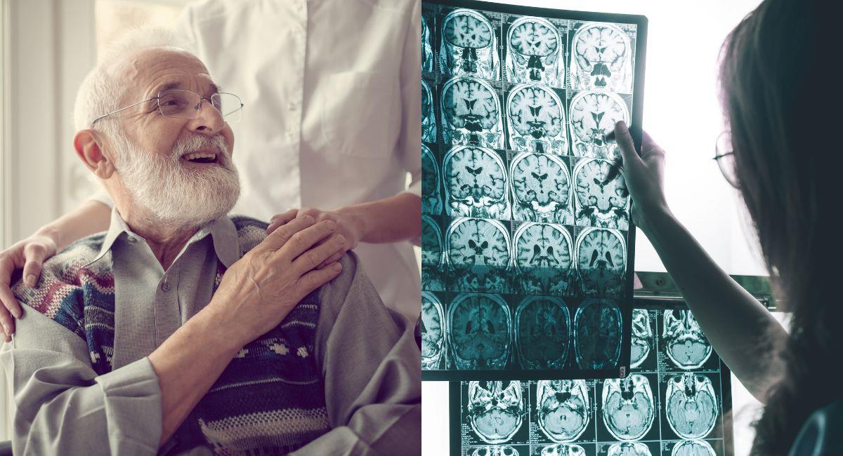 España desarrolla un método de detección temprana para el Alzheimer. Foto: Shutterstock