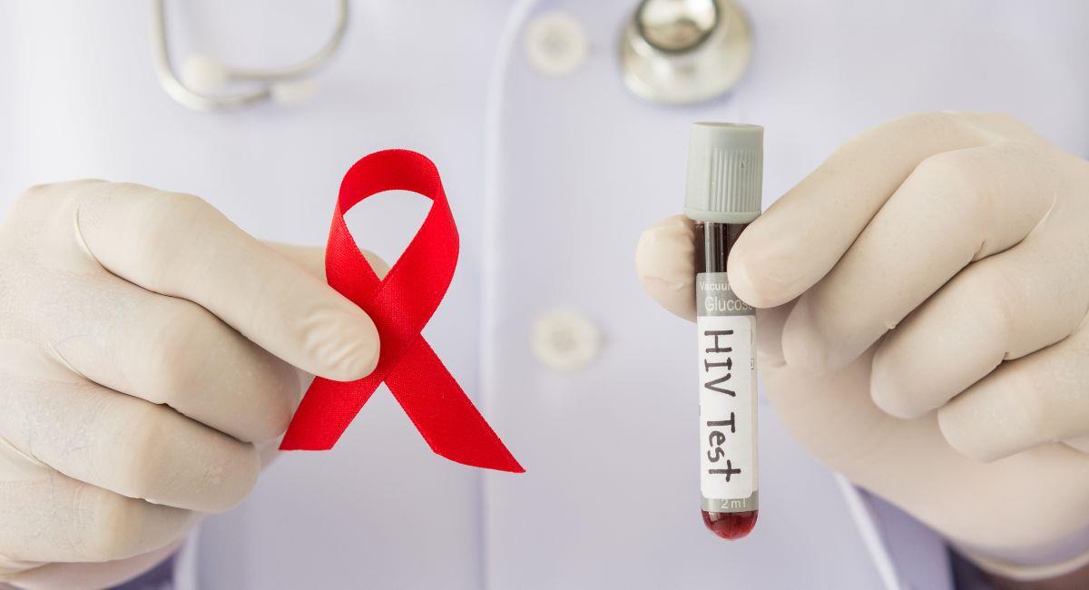 VIH/Sida dejó 27.000 víctimas mortales en 2022. Foto: Shutterstock
