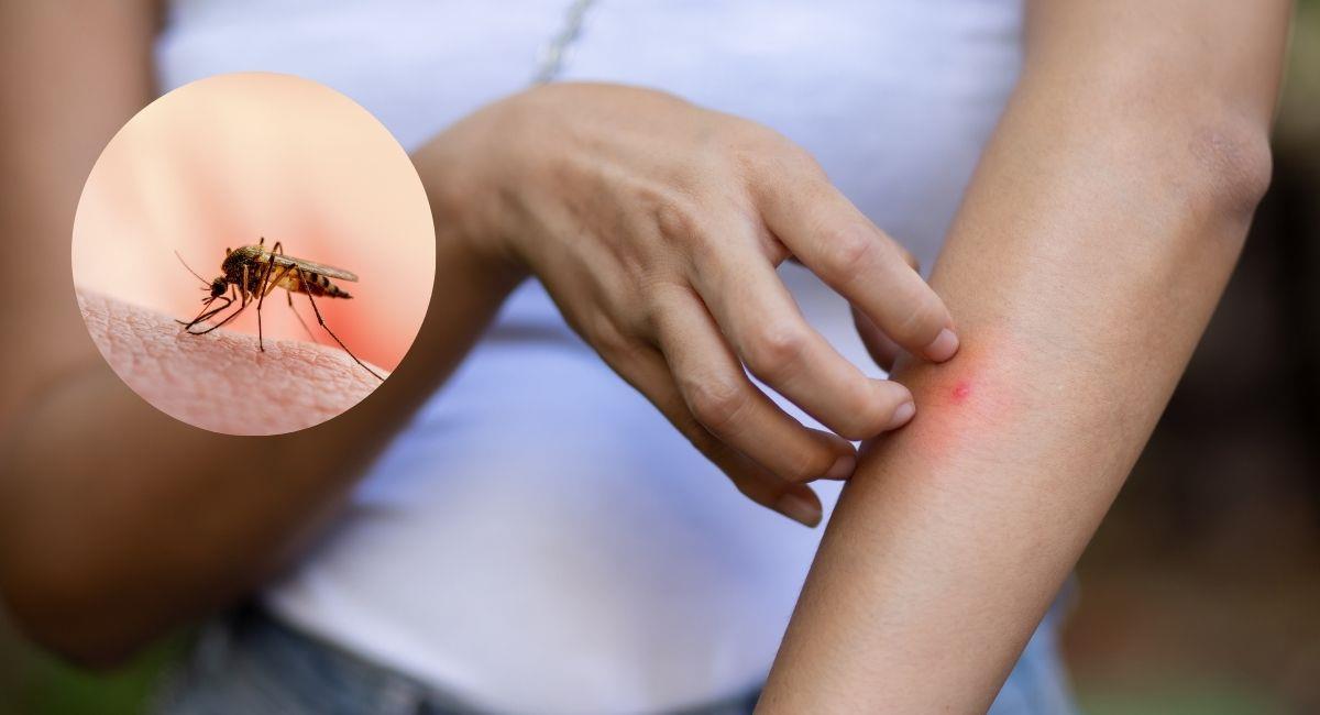La razón por la cual los mosquitos pican más a algunas personas. Foto: Shutterstock