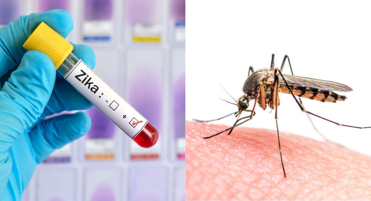 Nuevo estudio sugiere que el virus del Zika podría tratar el cáncer. Foto: Shutterstock