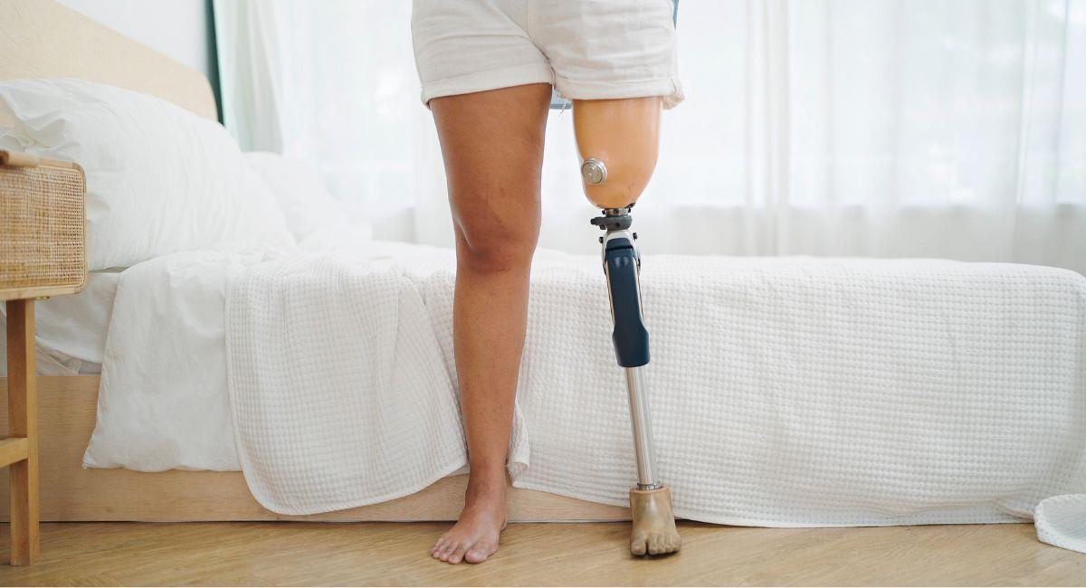 Modelo perdió sus piernas por mal uso de un tampón higiénico. Foto: Shutterstock