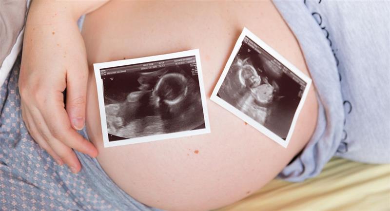 Mujer dio a luz 3 veces en 10 meses: ¿cómo ocurrió?