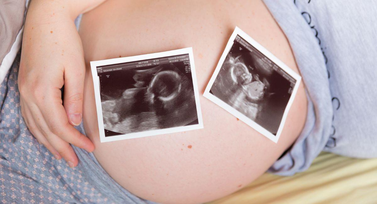 Mujer dio a luz 3 veces en 10 meses: ¿cómo ocurrió?. Foto: Shutterstock