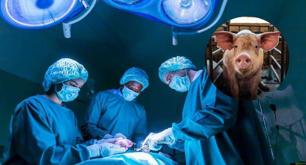 Paciente vivo recibió trasplante de riñón de cerdo genéticamente modificado. Foto: Shutterstock