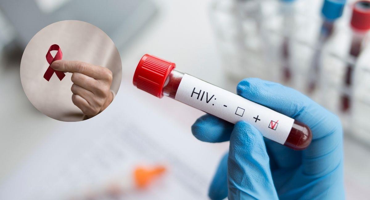 Encuentran tratamiento que podría eliminar el VIH. Foto: Shutterstock