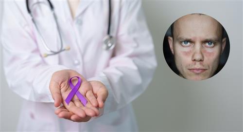 Lupus: una enfermedad que afecta a más de cinco millones de personas